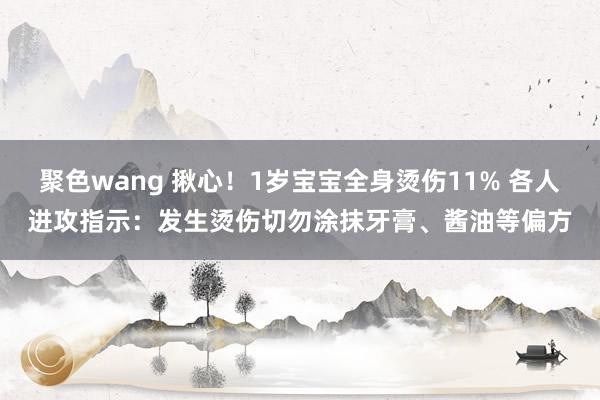 聚色wang 揪心！1岁宝宝全身烫伤11% 各人进攻指示：发生烫伤切勿涂抹牙膏、酱油等偏方